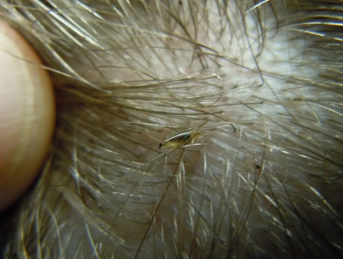 Lestad ei vaeva teid enam: tõestatud meetod teepuuõliga